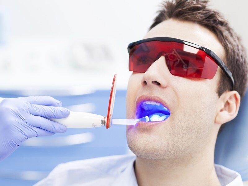 Lựa chọn phương pháp tẩy trắng răng phù hợp với tình trạng răng của bạn